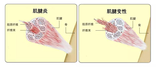 无锡病人康复锻炼